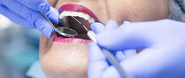 Best Emergency Wisdom Teeth Removal in Neffs, OH